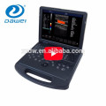 ДГ-С60 ноутбук базовой 4D функции оборудование цвет doppler портативный ультразвуковой аппарат